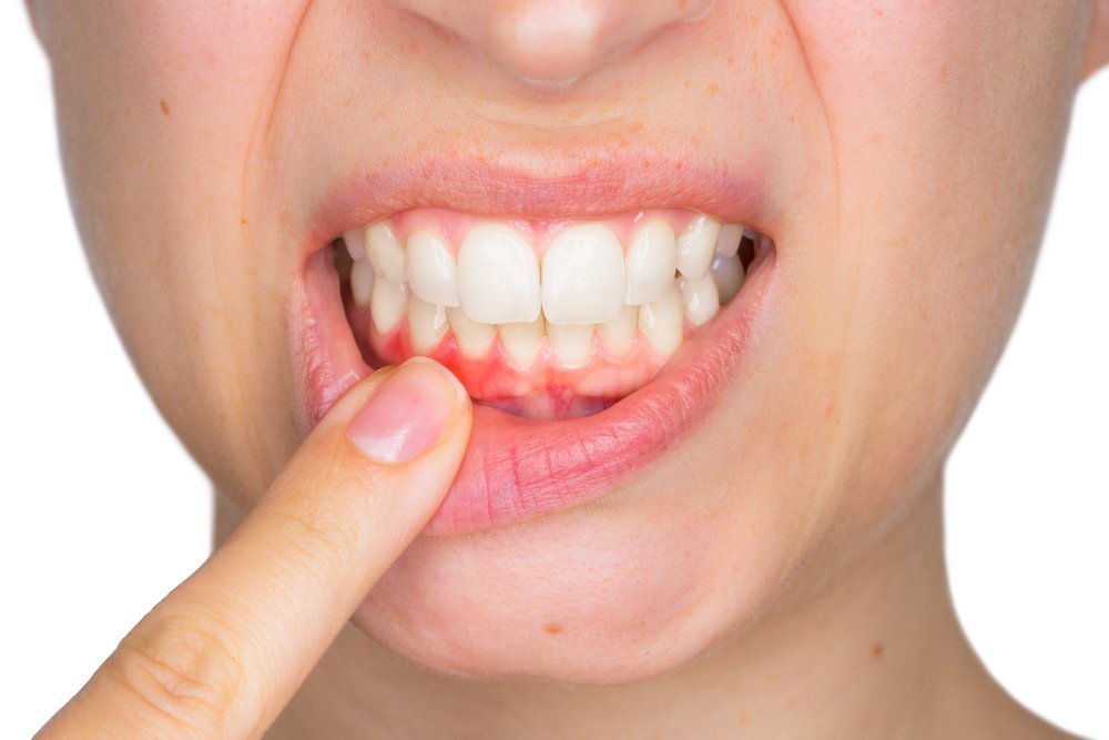 gum disease treatment in HSR