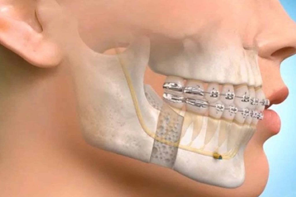 Oral Maxillofacial Surgery